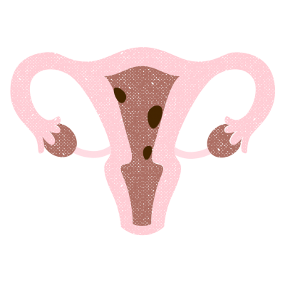 14.png